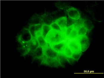 DNAI2 monoclonal antibody (M01), clone 1C8