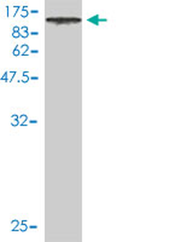 DNAI2 monoclonal antibody (M01), clone 1C8