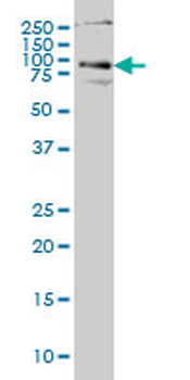 HHIP monoclonal antibody (M01), clone 5D11