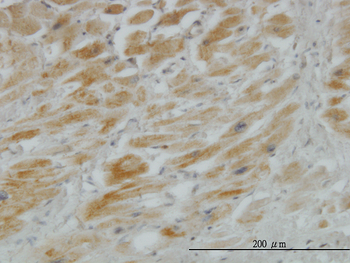 HHIP monoclonal antibody (M01), clone 5D11