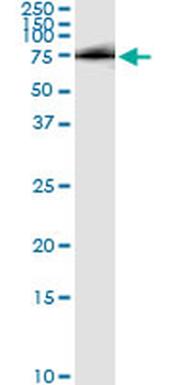 HHIP monoclonal antibody (M01), clone 5D11