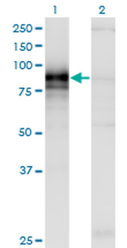 HHIP monoclonal antibody (M01), clone 5D11