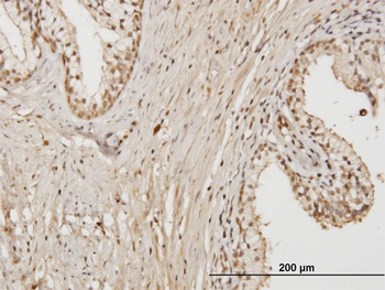 RAB17 monoclonal antibody (M01), clone 2A10