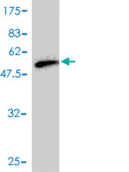 RAB17 monoclonal antibody (M01), clone 2A10