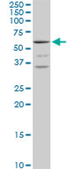 MCCC2 purified MaxPab mouse polyclonal antibody (B01P)