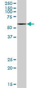 MCCC2 purified MaxPab mouse polyclonal antibody (B01P)