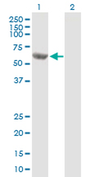 MCCC2 purified MaxPab mouse polyclonal antibody (B01P)