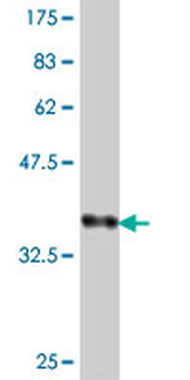 MCCC2 polyclonal antibody (A01)