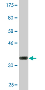 CIDEC monoclonal antibody (M07), clone 2E2