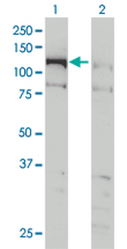 CHTF18 monoclonal antibody (M01), clone 1F5