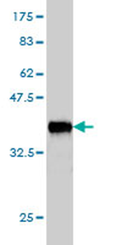 CHTF18 monoclonal antibody (M01), clone 1F5