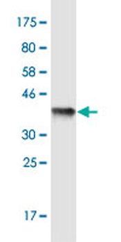 FKBP10 monoclonal antibody (M13), clone 2D4