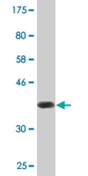 FKBP10 monoclonal antibody (M02), clone 3B5