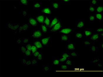 SAV1 monoclonal antibody (M02), clone 3B2