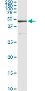 SAV1 monoclonal antibody (M02), clone 3B2