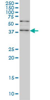 SAV1 monoclonal antibody (M02), clone 3B2