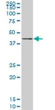 SAV1 monoclonal antibody (M02), clone 3B2