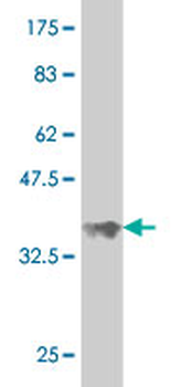 SAV1 monoclonal antibody (M02), clone 3B2