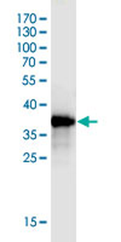 LGR7 monoclonal antibody (M01), clone 3E3
