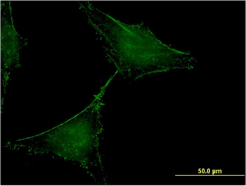 SLAMF7 monoclonal antibody (M01), clone 1B9