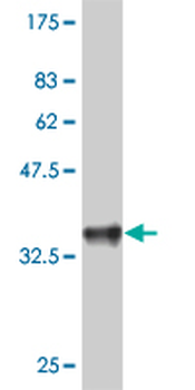 LSM2 polyclonal antibody (A01)