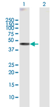 WDR19 MaxPab rabbit polyclonal antibody (D01)