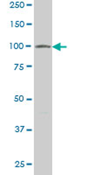VPS18 monoclonal antibody (M02), clone 2G10
