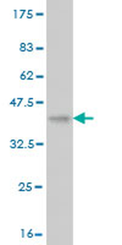 VPS18 monoclonal antibody (M02), clone 2G10