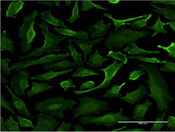 SRGAP1 monoclonal antibody (M07), clone 5D10