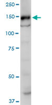 SRGAP1 monoclonal antibody (M07), clone 5D10