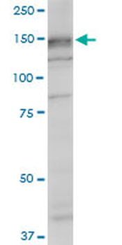 SRGAP1 monoclonal antibody (M07), clone 5D10