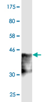 SRGAP1 monoclonal antibody (M07), clone 5D10