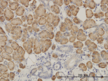 SRGAP1 monoclonal antibody (M03), clone 5D2
