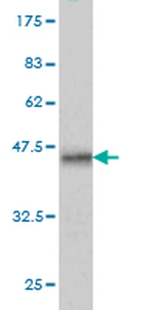 SRGAP1 monoclonal antibody (M03), clone 5D2