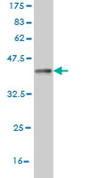 COG6 monoclonal antibody (M01), clone 5B5