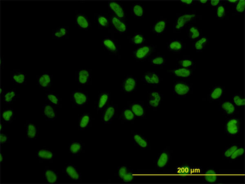 XPO5 monoclonal antibody (M01), clone 2C5-1B3
