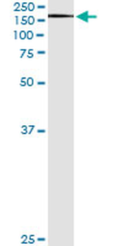 XPO5 monoclonal antibody (M01), clone 2C5-1B3