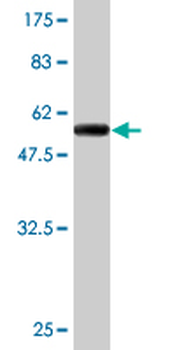 XPO5 monoclonal antibody (M01), clone 2C5-1B3