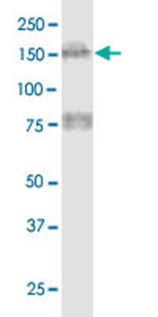 MTUS1 monoclonal antibody (M01), clone 1C7