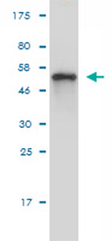 MTUS1 monoclonal antibody (M01), clone 1C7