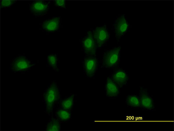 ARID1B monoclonal antibody (M02), clone 2F2