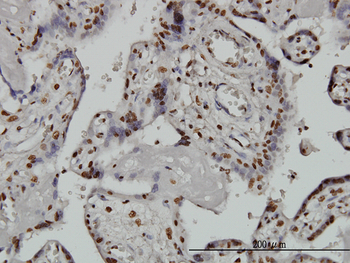 ARID1B monoclonal antibody (M02), clone 2F2