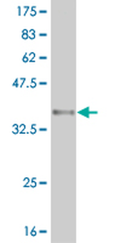 ARID1B monoclonal antibody (M02), clone 2F2