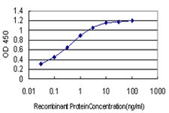 ARID1B monoclonal antibody (M01), clone 2D2