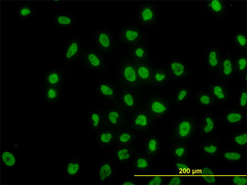 ARID1B monoclonal antibody (M01), clone 2D2