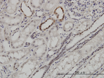 ARID1B monoclonal antibody (M01), clone 2D2