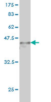 ARID1B monoclonal antibody (M01), clone 2D2