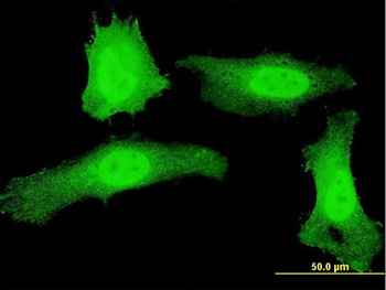 PLEKHG5 monoclonal antibody (M01), clone 5A9