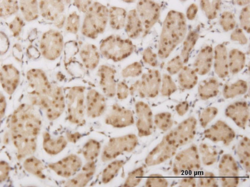 PLEKHG5 monoclonal antibody (M01), clone 5A9