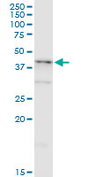 NDRG2 monoclonal antibody (M03), clone 6A5